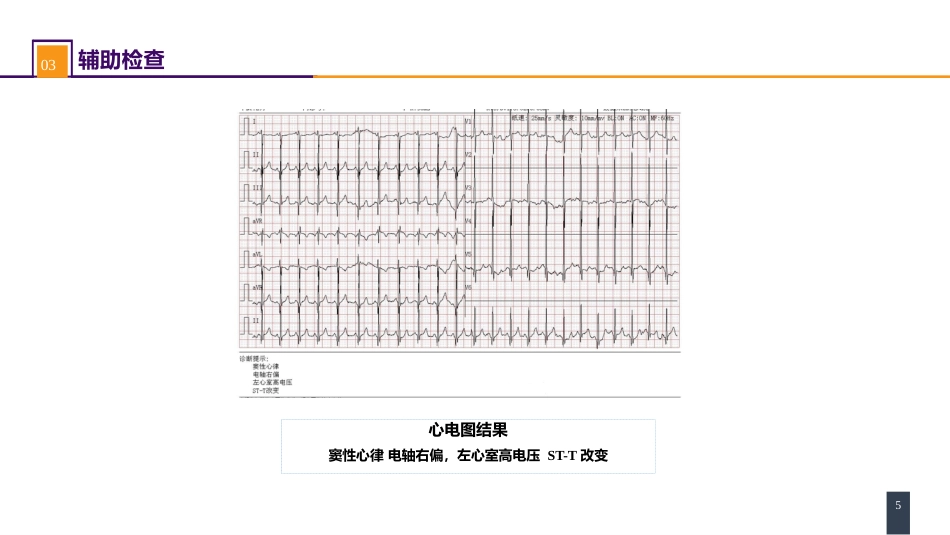 外科学：心脏疾病案例分析-室间隔缺损_第5页