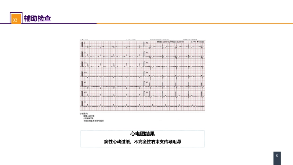 外科学：心脏疾病案例分析-房间隔缺损_第5页