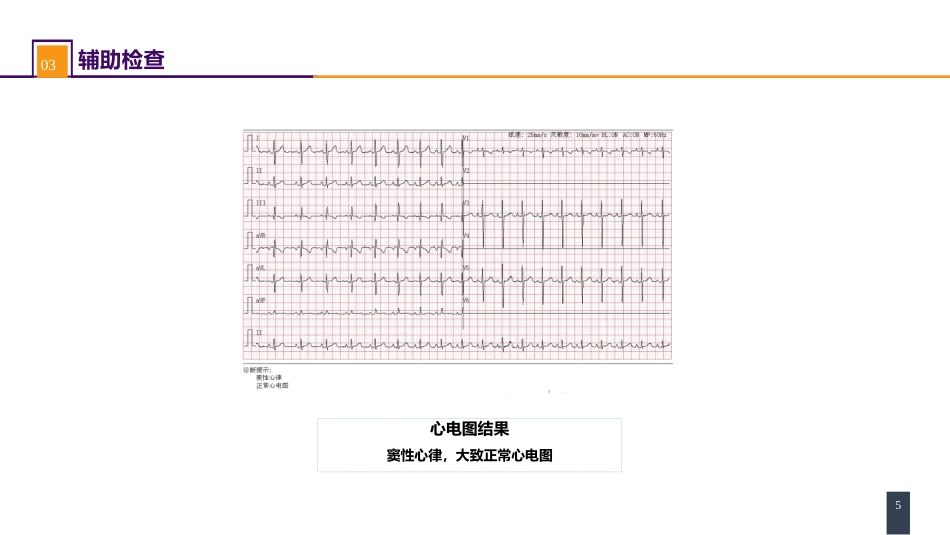 外科学：心脏疾病案例分析-法洛四联症_第5页