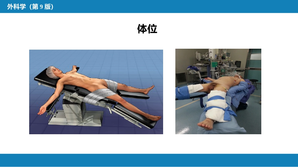 外科学：食管疾病腹腔镜胃底折叠术技术要领_第9页