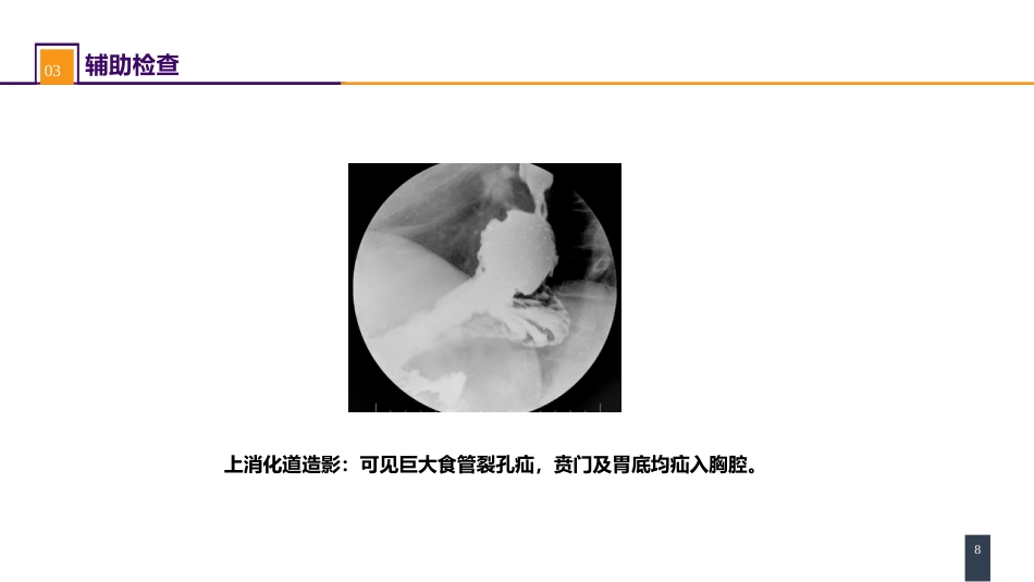 外科学：食管疾病案例分析-胃食管反流病_第8页