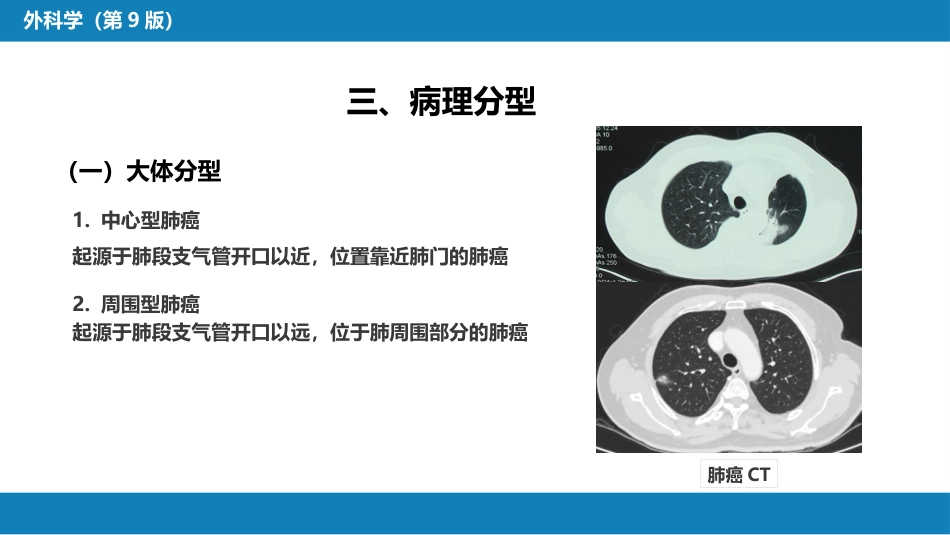 外科学：肺疾病_第7页