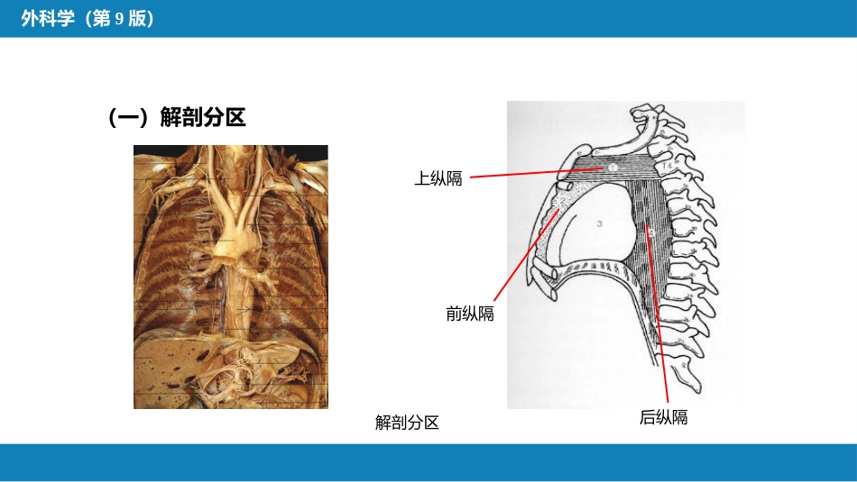 外科学：原发性纵隔肿瘤_第4页