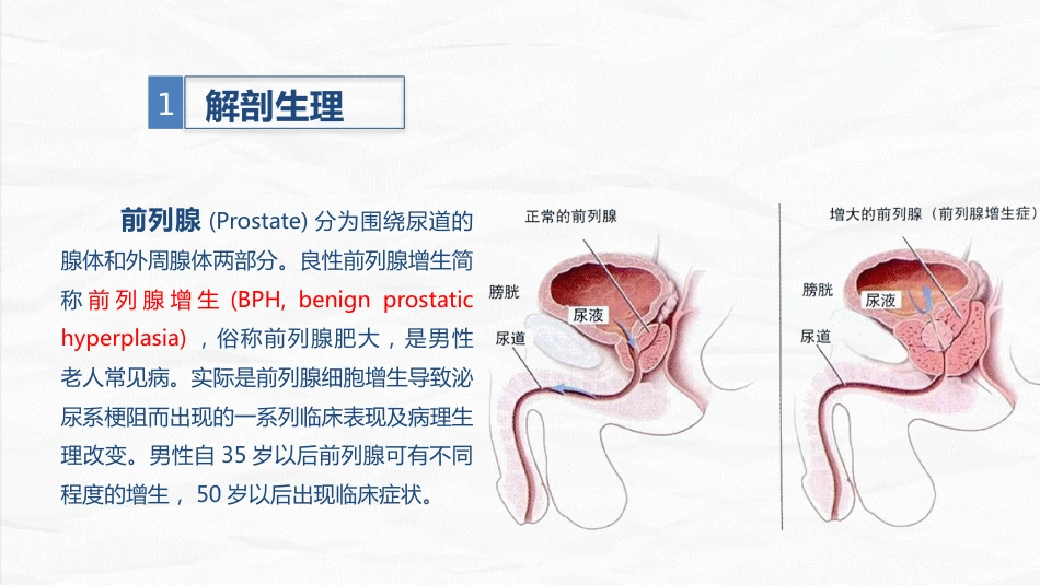 男科-前列腺增生护理查房_第4页