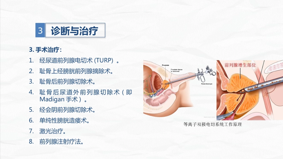 男科-前列腺增生护理查房_第8页