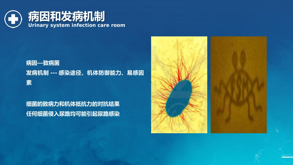 泌尿系统感染护理查房_第8页