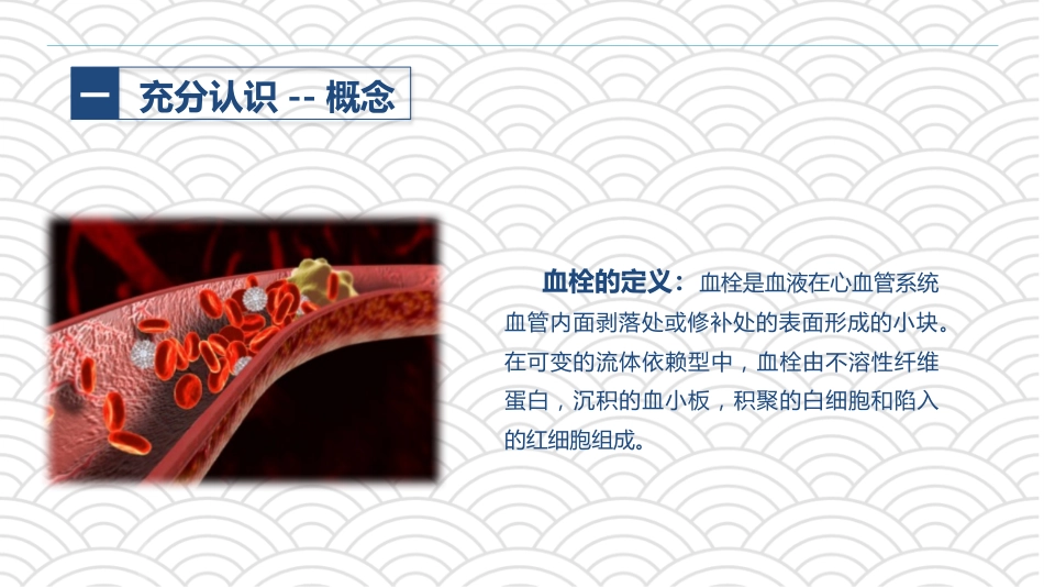 PICC相关静脉血栓护理的业务学习_第4页