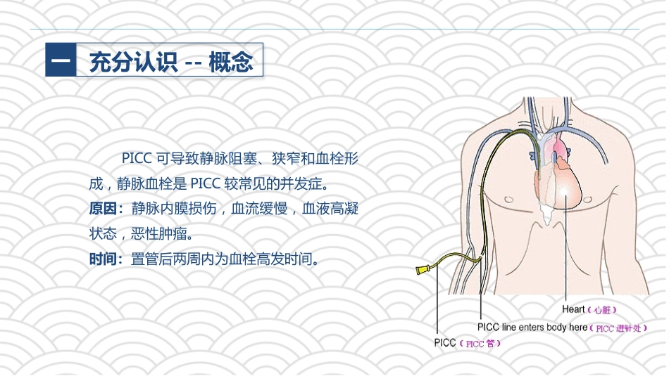 PICC相关静脉血栓护理的业务学习_第5页