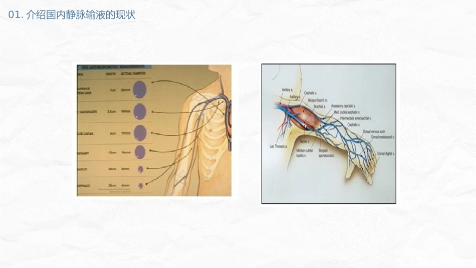 静脉输液安全问题_第12页