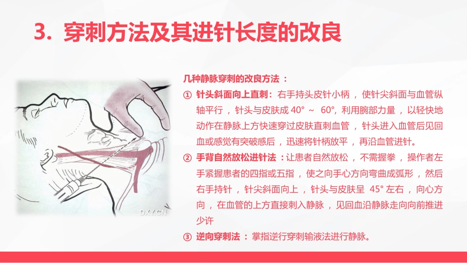 静脉输液护理新进展_第15页