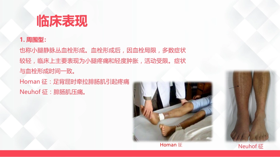 深静脉血栓的护理-业务学习_第12页