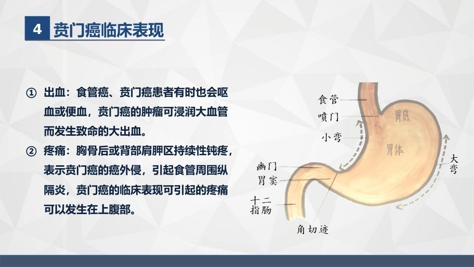 普外科-贲门癌伴脓胸吻合口瘘护理查房2_第7页