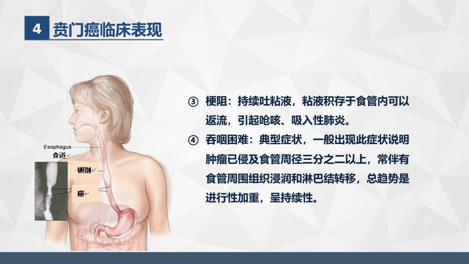 普外科-贲门癌伴脓胸吻合口瘘护理查房2_第8页