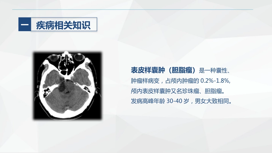 外科-颅内表皮样囊肿患者的护理查房_第4页