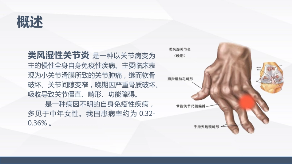 类风湿性关节炎的护理_第4页