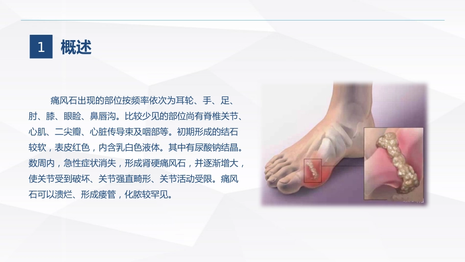 痛风石病人的护理_第5页