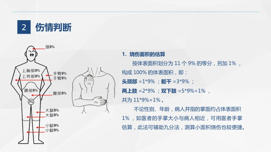 烧伤科-烧伤患者的护理查房_第5页