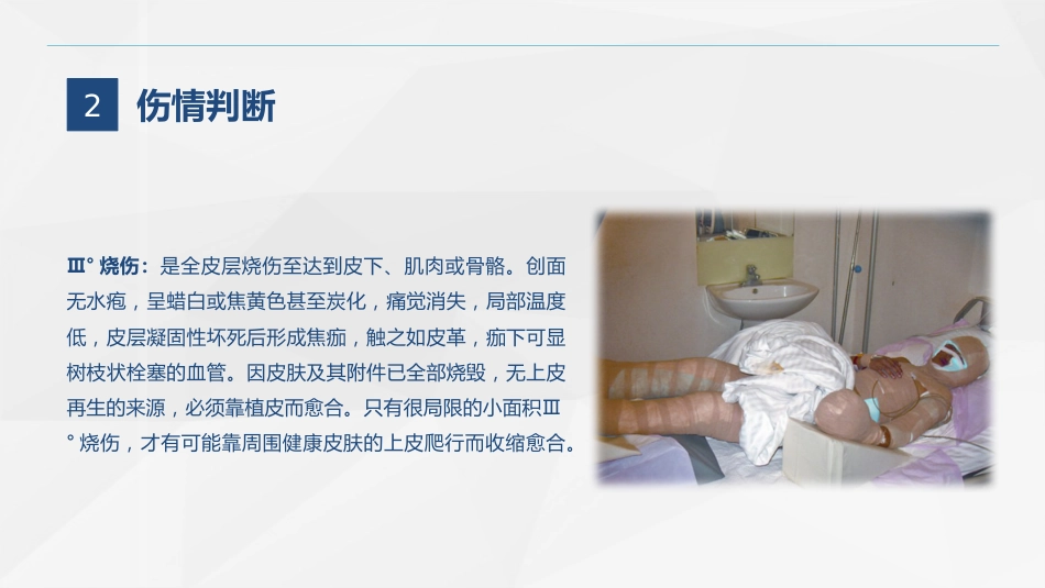 烧伤科-烧伤患者的护理查房_第8页