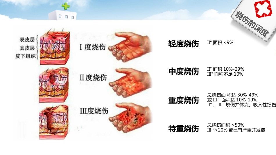 烧伤病人护理 (2)_第9页