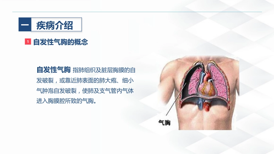 结核病科-结核性胸膜炎患者自发性气胸的护理查房_第4页