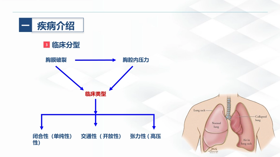 结核病科-结核性胸膜炎患者自发性气胸的护理查房_第6页