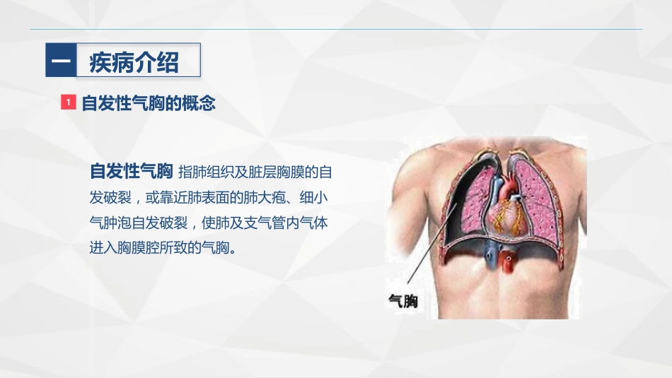 胸科-胸膜炎患者自发性气胸的护理查房_第4页