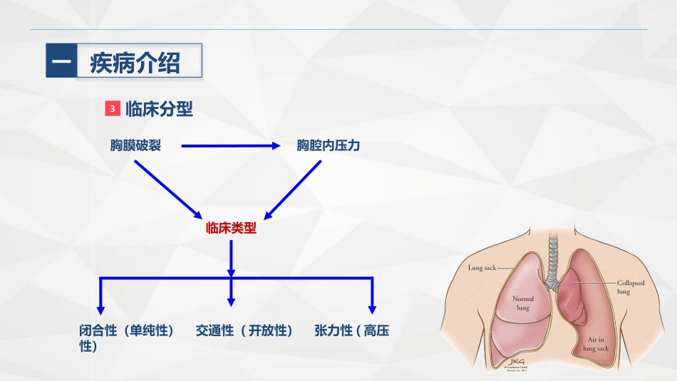 胸科-胸膜炎患者自发性气胸的护理查房_第6页