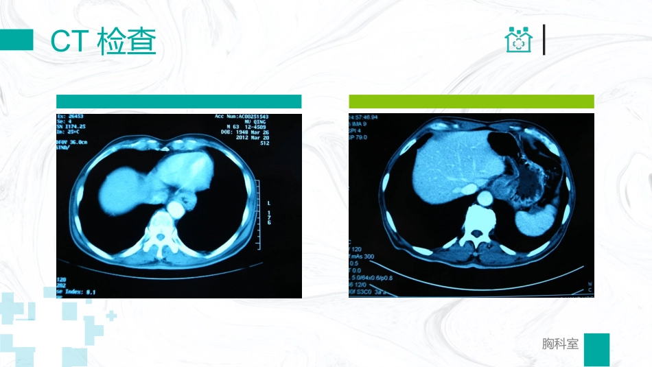 胸外科病例汇报_第9页