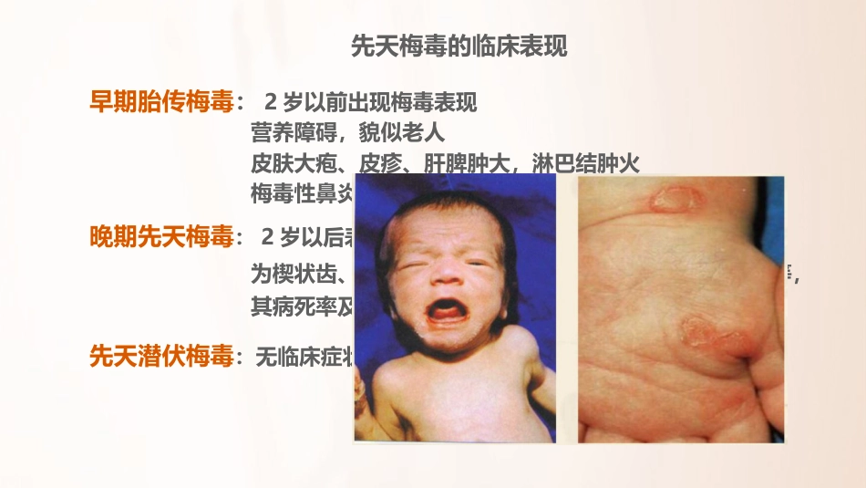 2020HIV和梅毒感染母亲所生儿童的管理_第13页