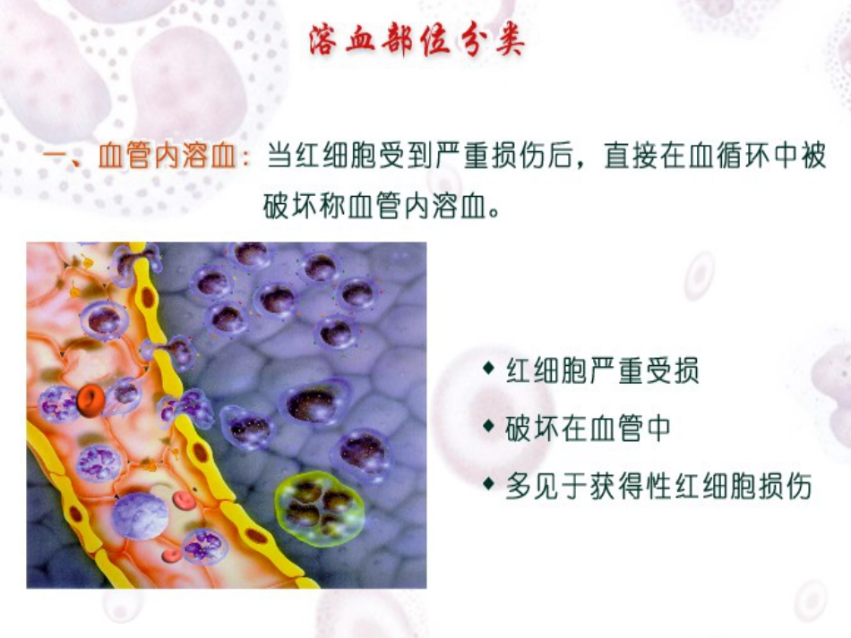 2017溶血性贫血_第10页