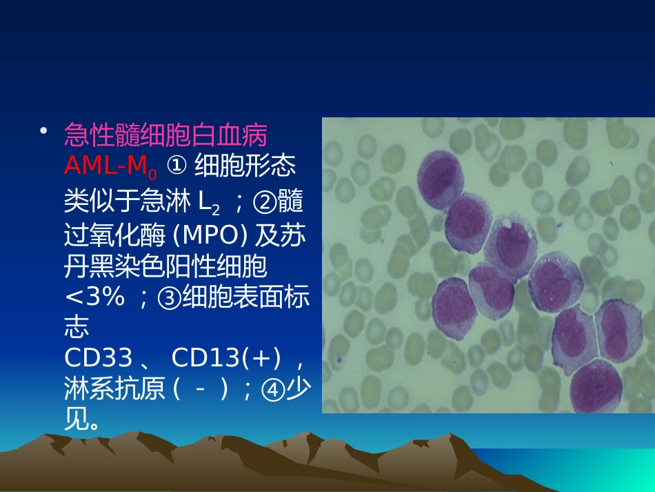《急性白血病》PPT课件_第15页