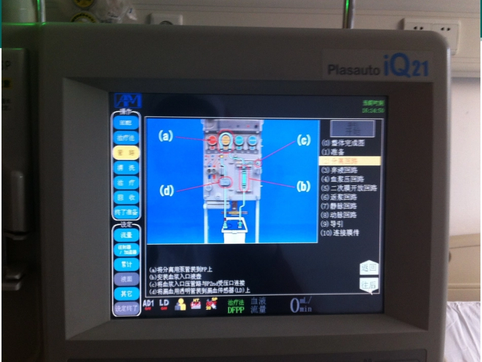 双重血浆置换的操作流程_第10页