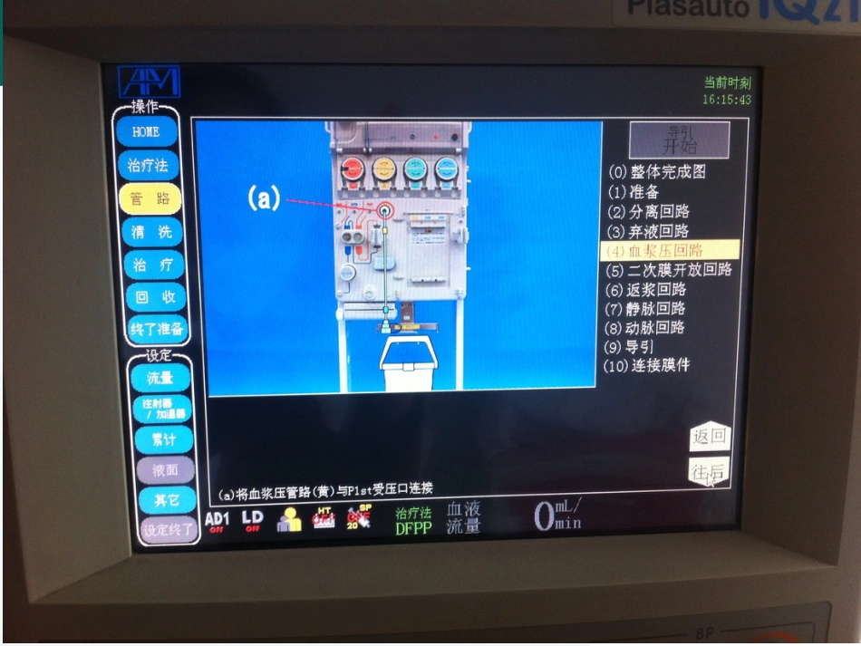 双重血浆置换的操作流程_第14页