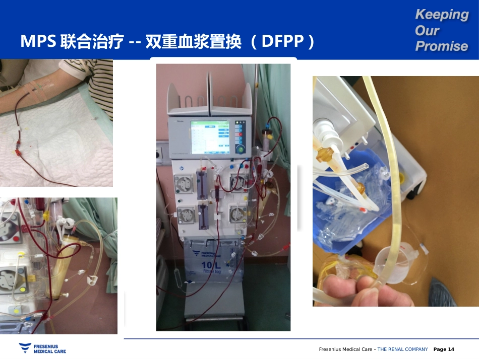 双重血浆置换_第14页