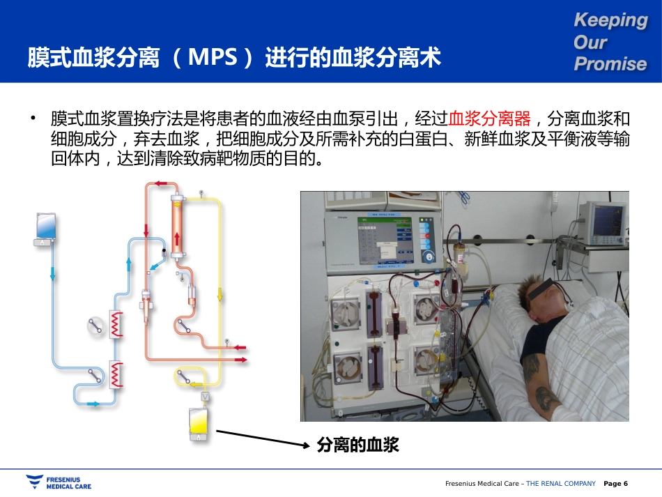 双重血浆置换_第6页