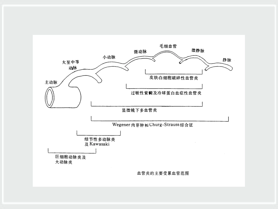 ANCA相关性小血管炎诊治进展_第4页