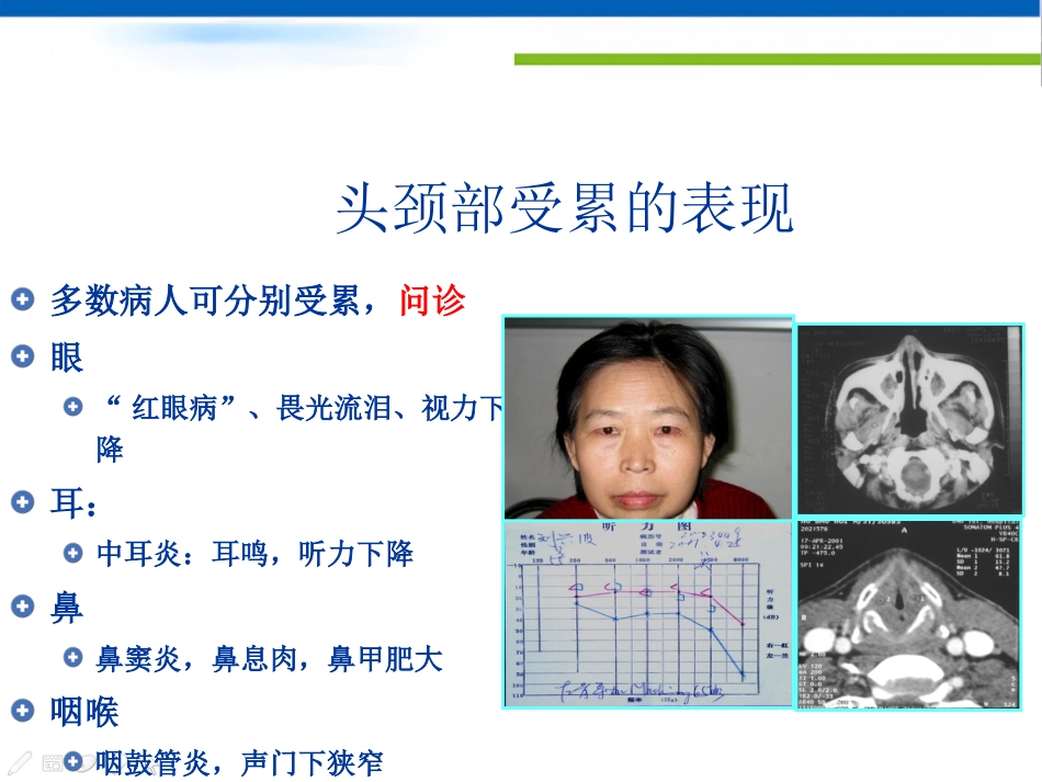 ANCA相关性小血管炎的诊治_第6页