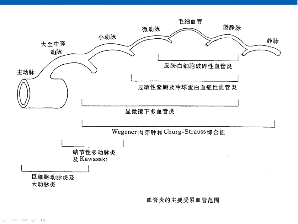 ANCA相关性小血管炎_第3页