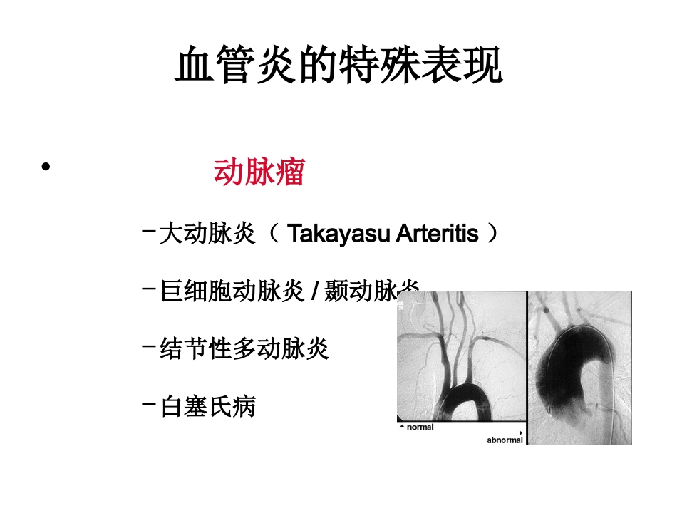 ANCA相关性小血管炎(2)_第14页