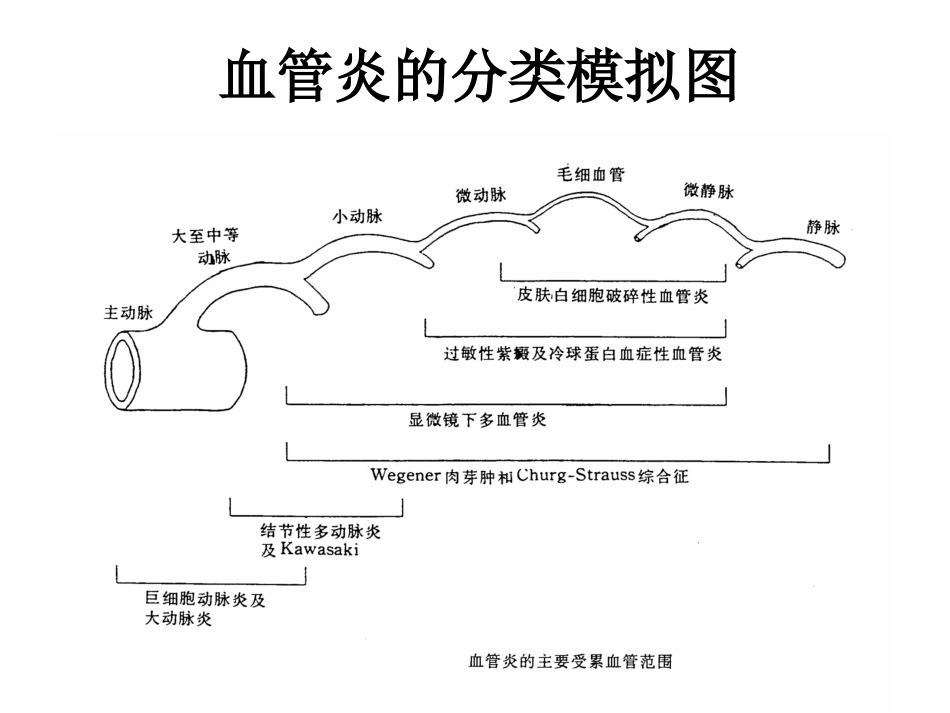 ANCA相关性小血管炎(2)_第3页