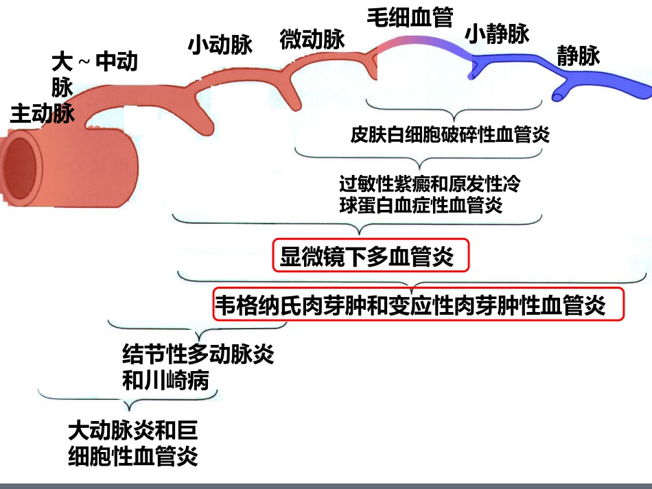 ANCA相关性小血管炎(1)_第3页