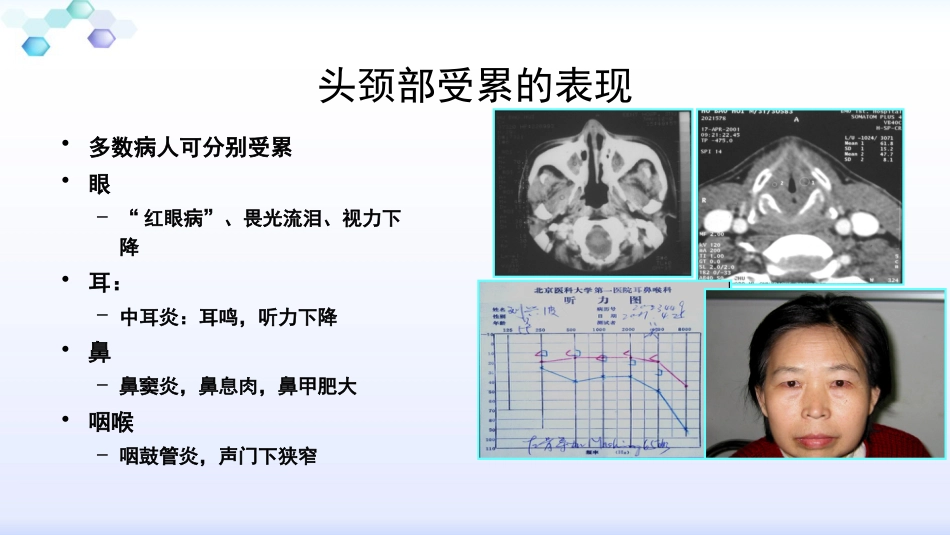 anca相关小血管炎的诊治_第10页