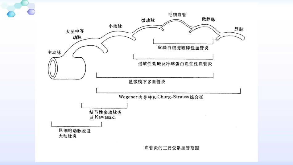 anca相关小血管炎的诊治_第4页
