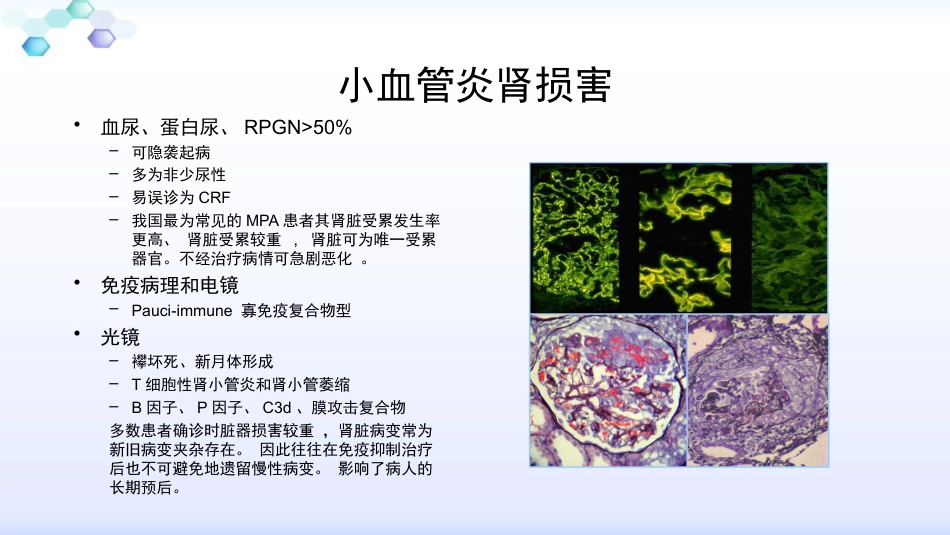 anca相关小血管炎的诊治_第8页