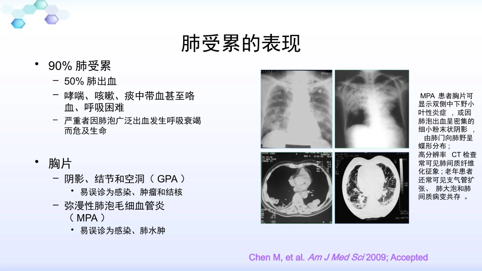 anca相关小血管炎的诊治_第9页