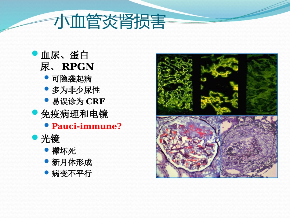 ANCA相关小血管炎的诊断和治疗_第13页