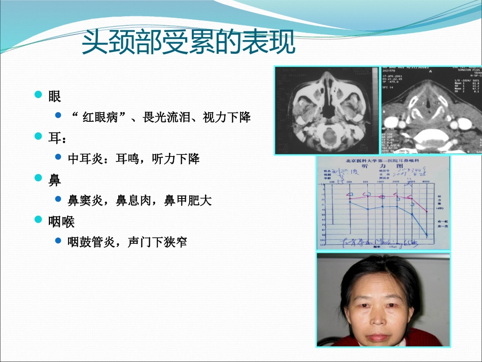 ANCA相关小血管炎的诊断和治疗_第14页