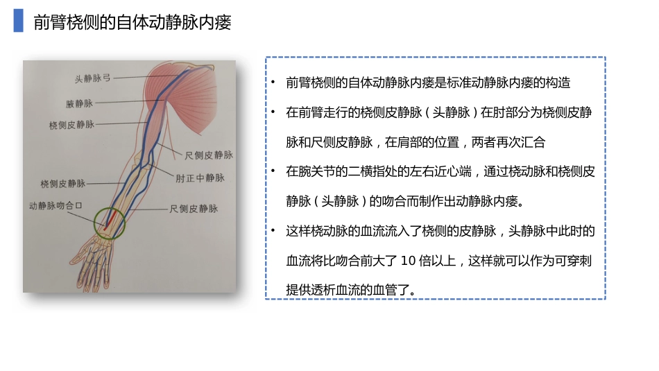 动静脉内瘘血管解剖及穿刺技巧_第10页