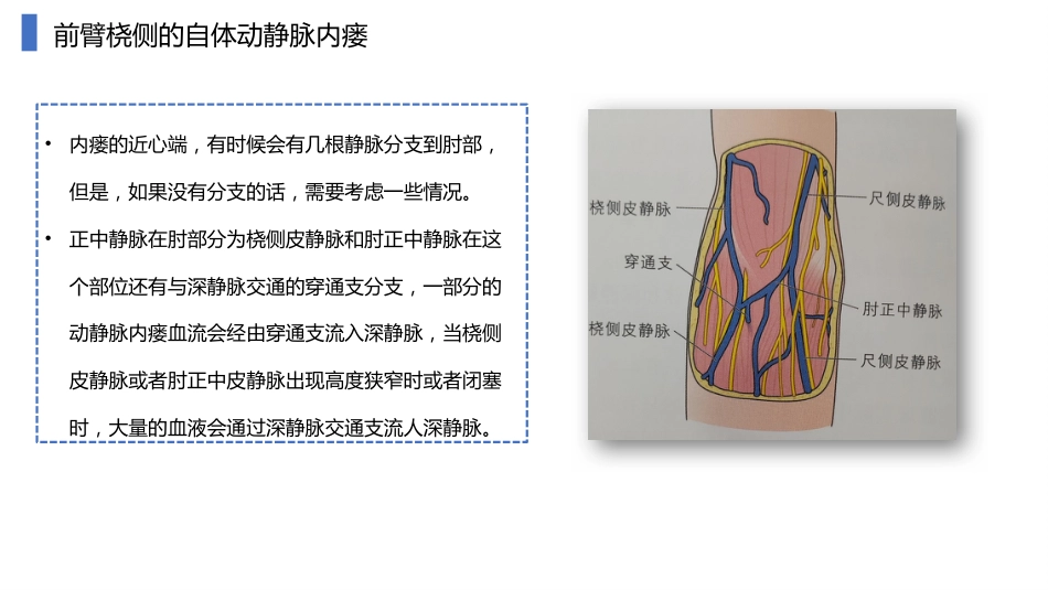 动静脉内瘘血管解剖及穿刺技巧_第13页