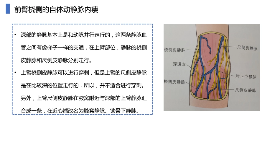 动静脉内瘘血管解剖及穿刺技巧_第14页